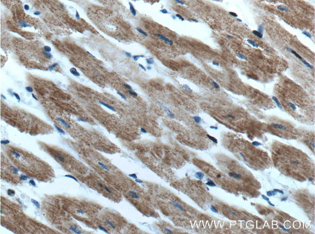 HADHA antibody (10758-1-AP) | Proteintech