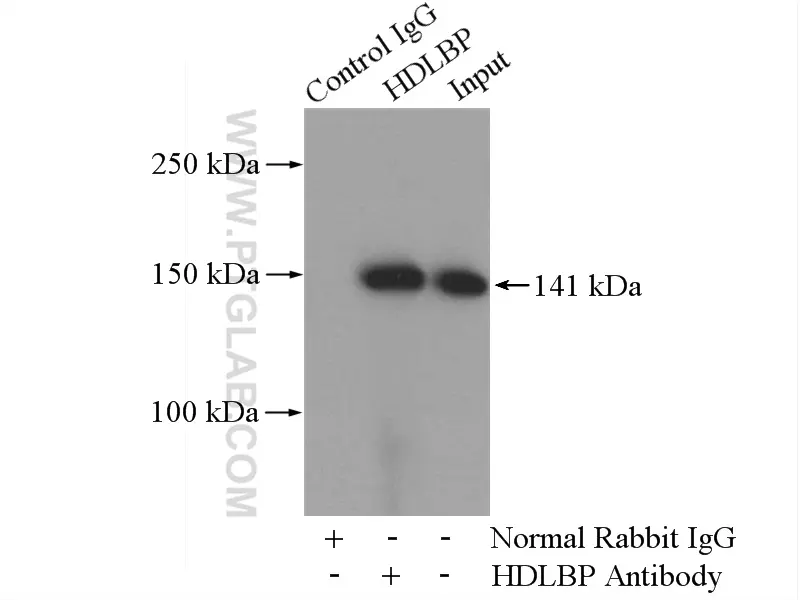 HDLBP antibody (15406-1-AP) | Proteintech