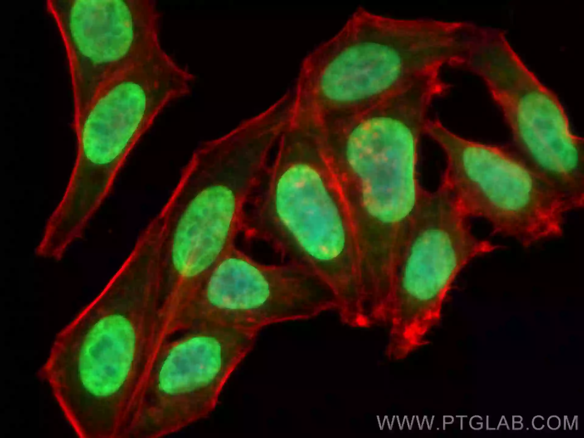 Genome-wide distribution of linker histone H1.0 is independent of MeCP2