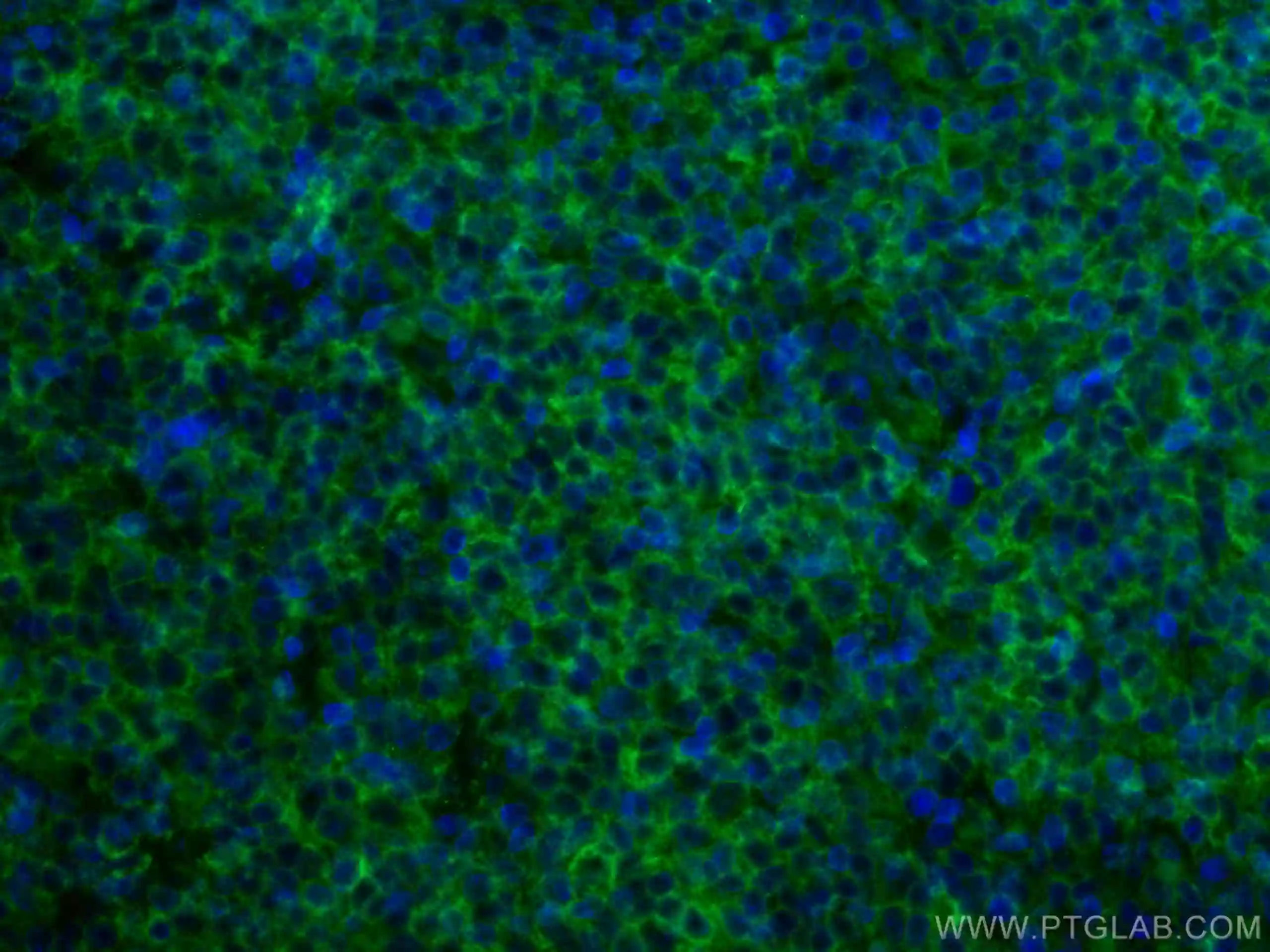 HLA class I ABC antibody (CL488-66013) | Proteintech