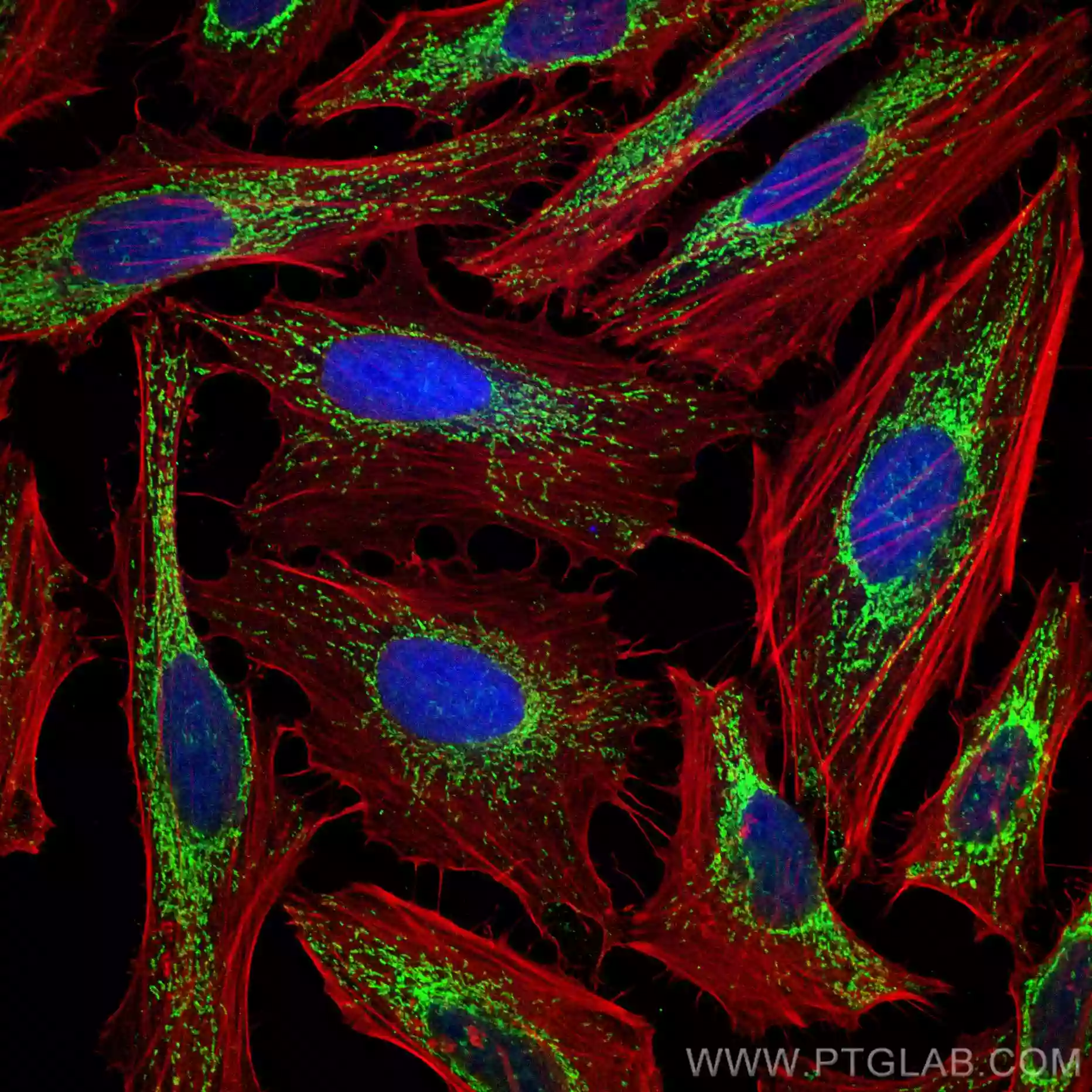 Immunofluorescent analysis of (4% PFA) fixed HeLa cells using HSP60 antibody