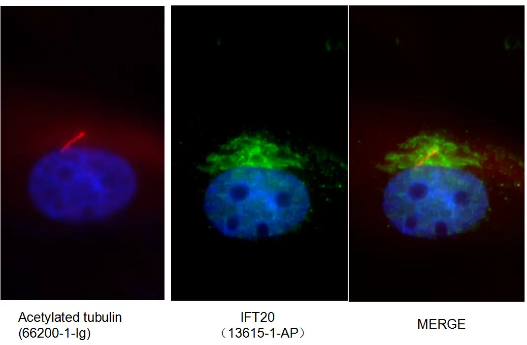 IFT20 antibody (13615-1-AP) | Proteintech