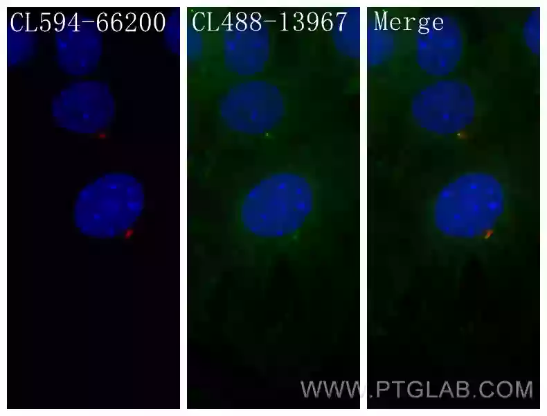 IFT88 antibody (CL488-13967) | Proteintech