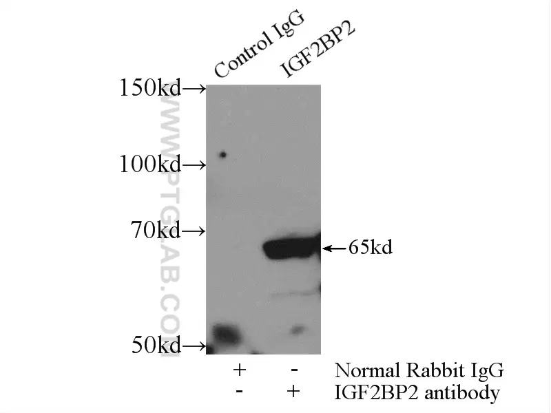 IGF2BP2 antibody 11601 1 AP Proteintech