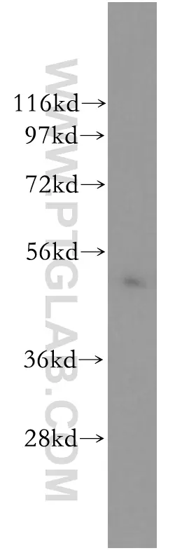 Human IgA Heavy Chain antibody (11449-1-AP) | Proteintech
