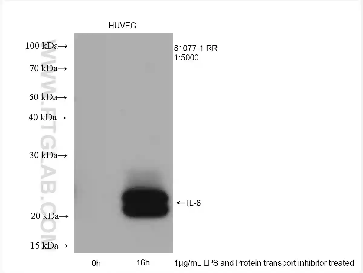 IL-6 antibody (81077-1-RR) | Proteintech
