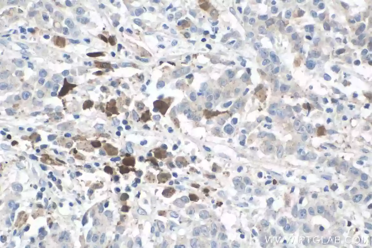 IL-18 antibody (60070-1-Ig) | Proteintech