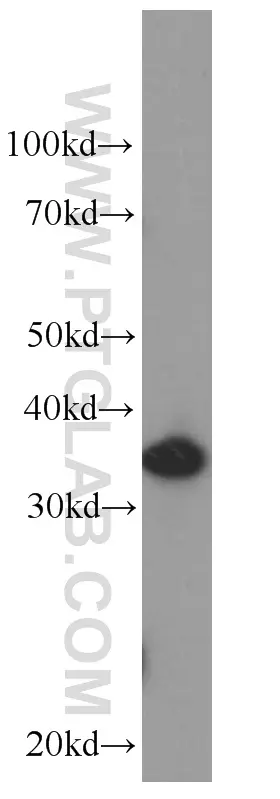 IL-22RA2 antibody (66190-1-Ig) | Proteintech