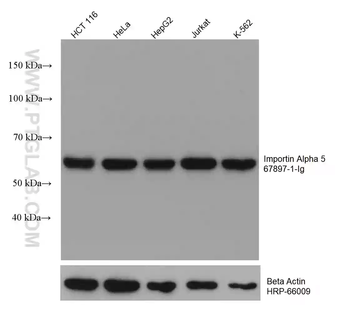Importin Alpha 5 antibody (67897-1-Ig) | Proteintech