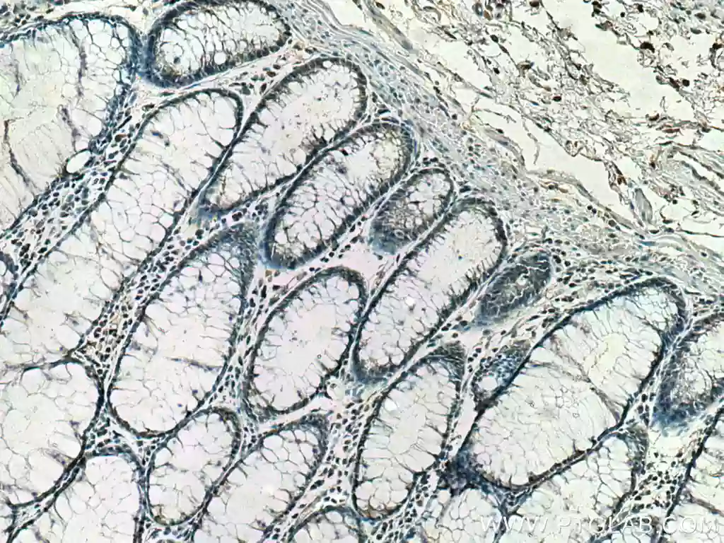 Importin Beta antibody (67597-1-Ig) | Proteintech