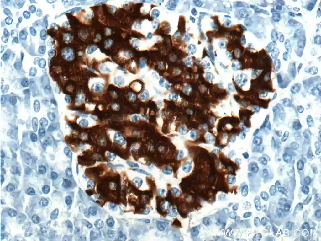 INS antibody (66198-1-Ig) | Proteintech