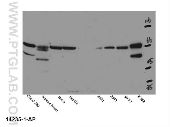 KCNN2 (KCa2.2, SK2) Polyclonal Antibody (APC-028-200UL)