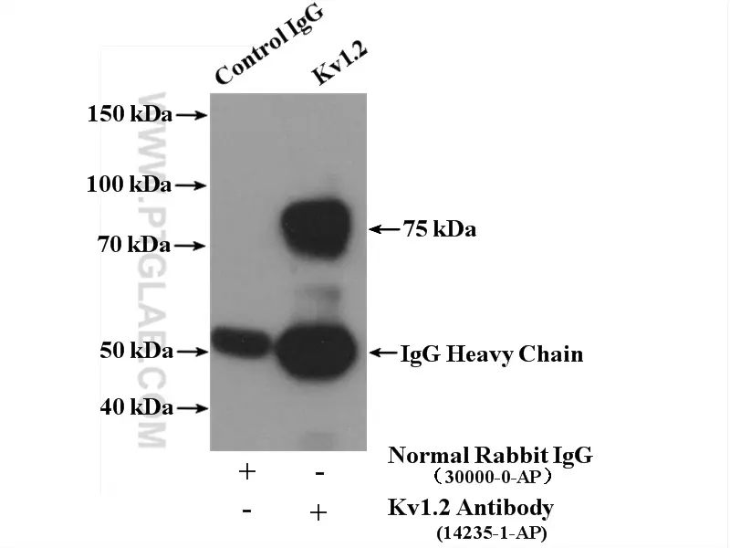 KCNN2 (KCa2.2, SK2) Polyclonal Antibody (APC-028-200UL)