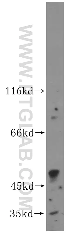 Kir6.2 antibody (16920-1-AP) | Proteintech