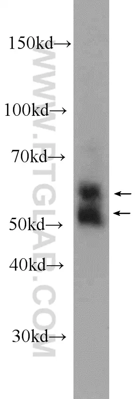 KMO antibody (10698-1-AP) | Proteintech