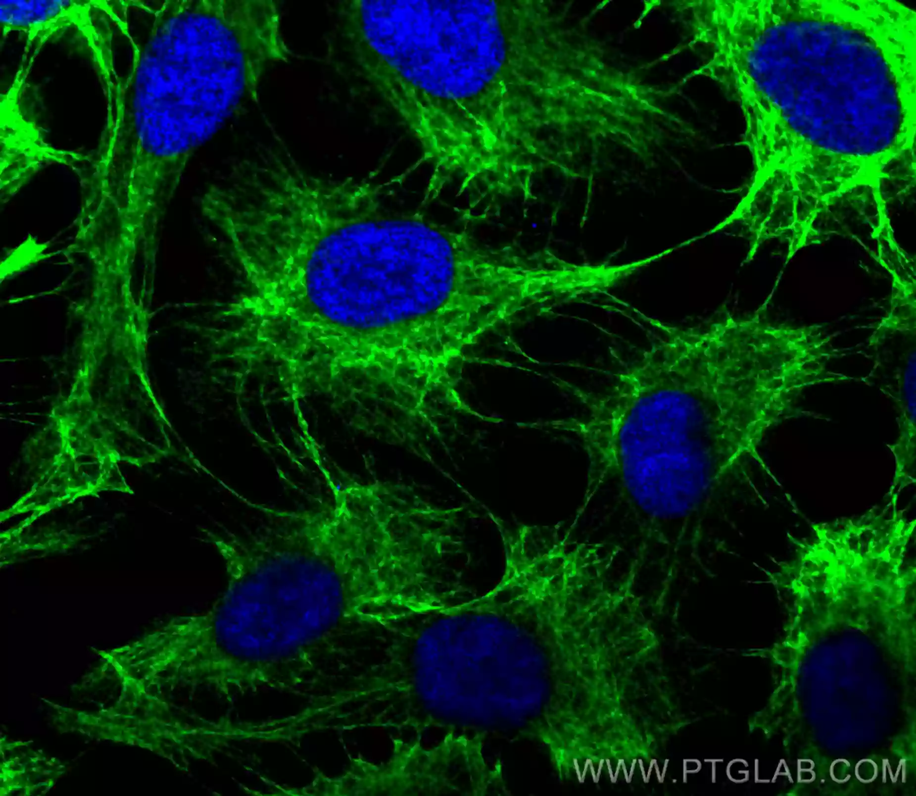 Cytokeratin 13 antibody (10164-2-AP) | Proteintech