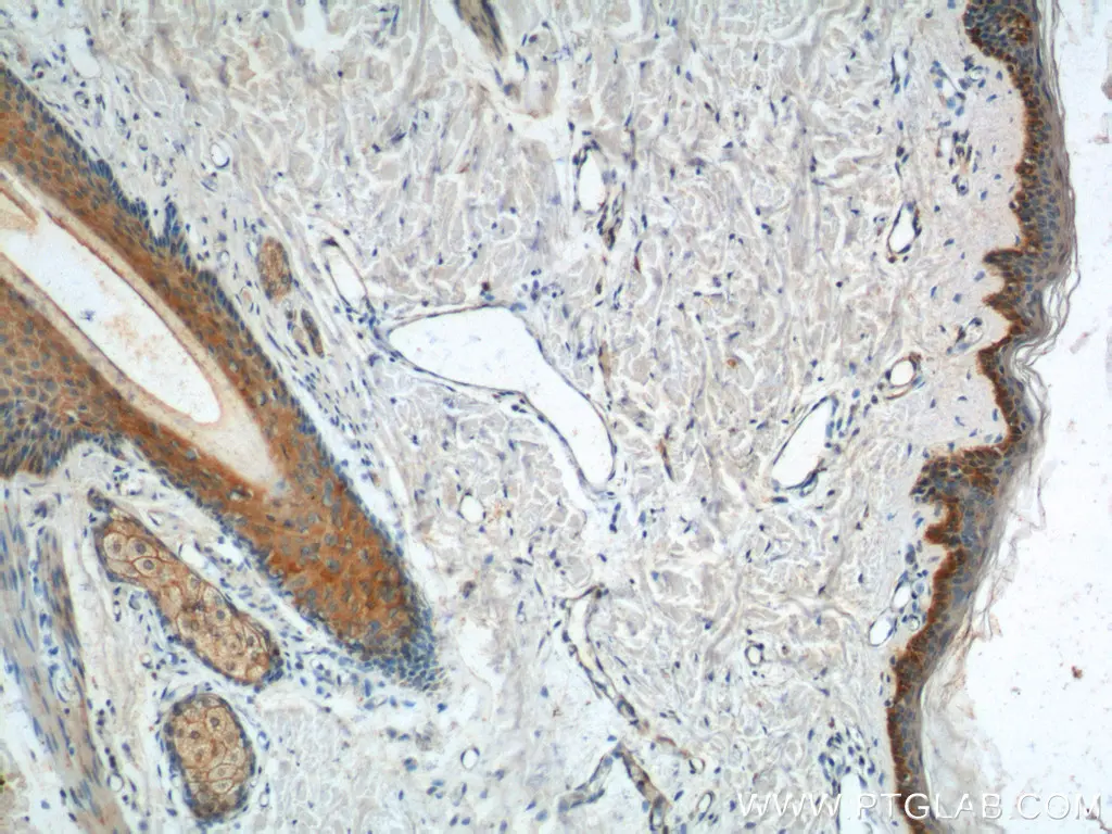 Cytokeratin 14 antibody (22221-1-AP) | Proteintech