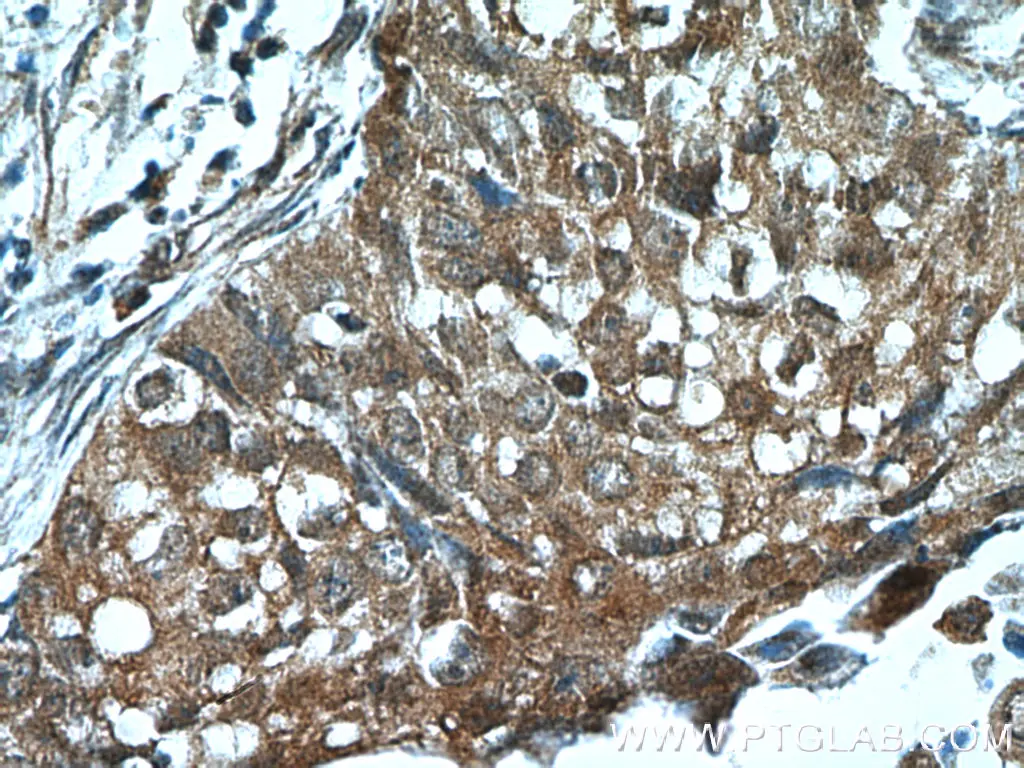 Cytokeratin 14 antibody (22221-1-AP) | Proteintech