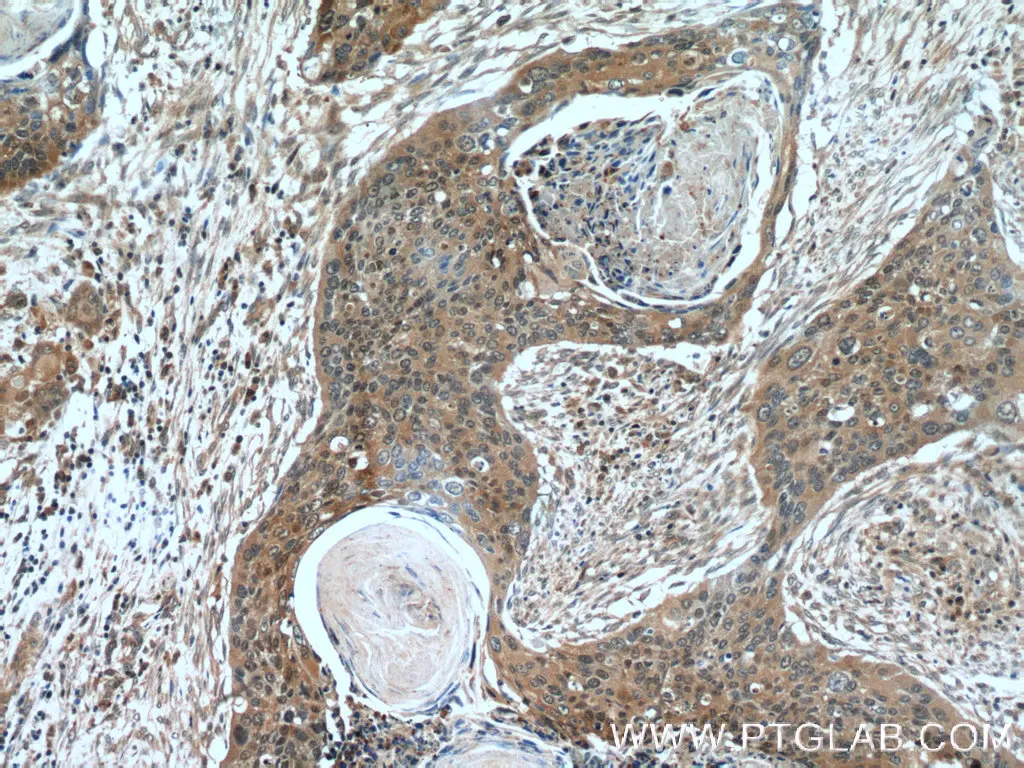 Cytokeratin 14 antibody (22221-1-AP) | Proteintech