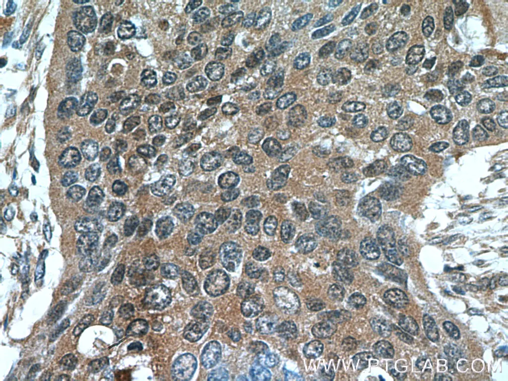 Cytokeratin 14 antibody (22221-1-AP) | Proteintech