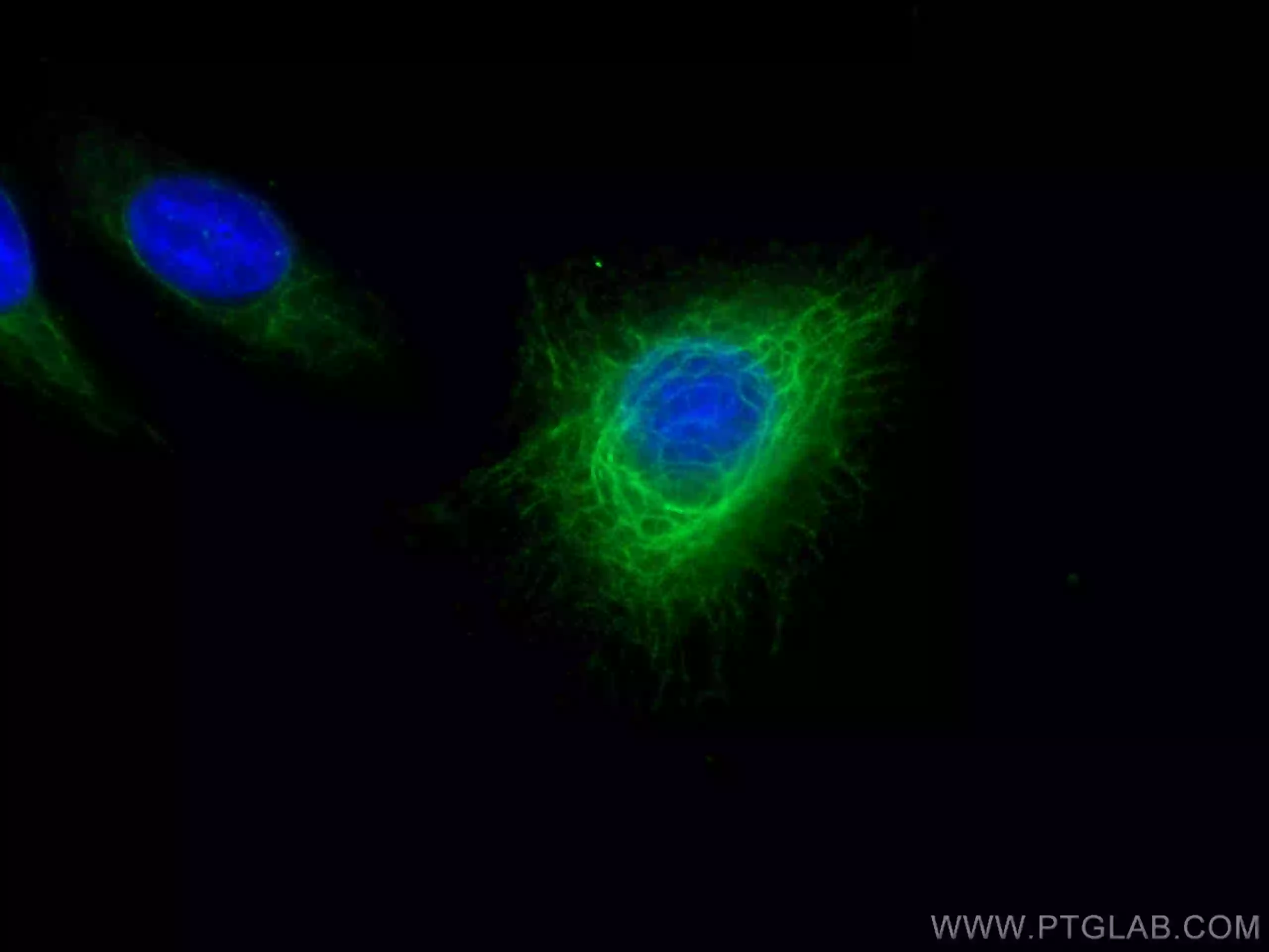 Cytokeratin 6A antibody (10590-1-AP) | Proteintech