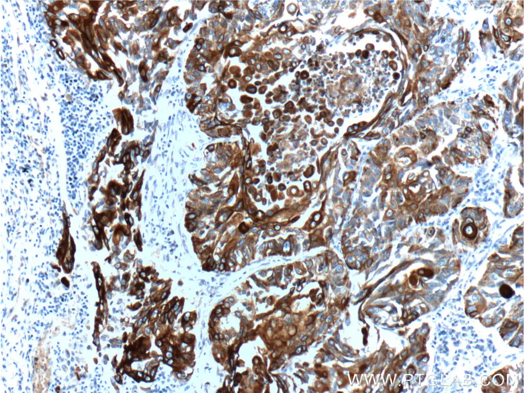 Cytokeratin 6A antibody (10590-1-AP) | Proteintech