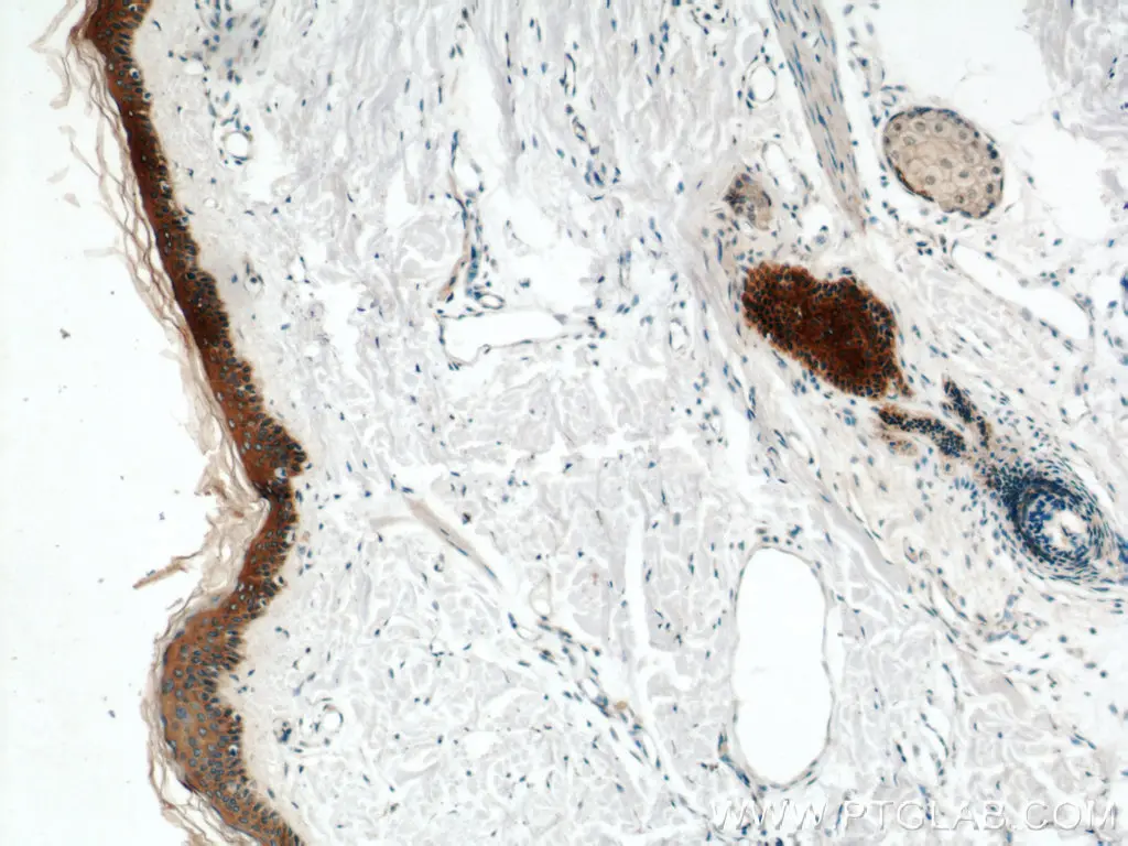 Cytokeratin 6A antibody (10590-1-AP) | Proteintech