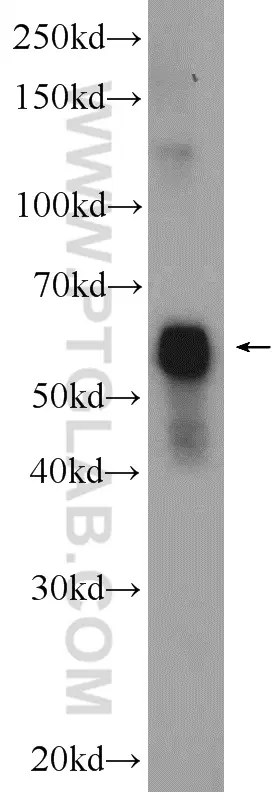 Cytokeratin 6A antibody (10590-1-AP) | Proteintech