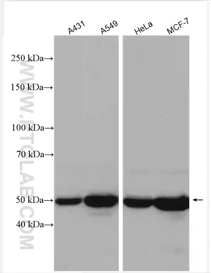 Cytokeratin 8 antibody (17514-1-AP) | Proteintech