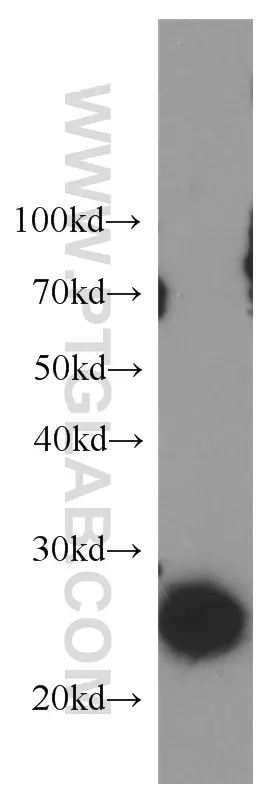 LAPTM4B antibody (18895-1-AP) | Proteintech