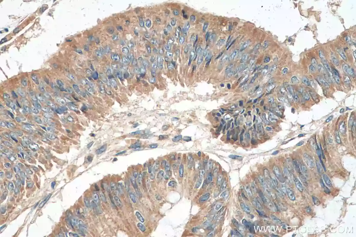 LARS2 antibody (17097-1-AP) | Proteintech