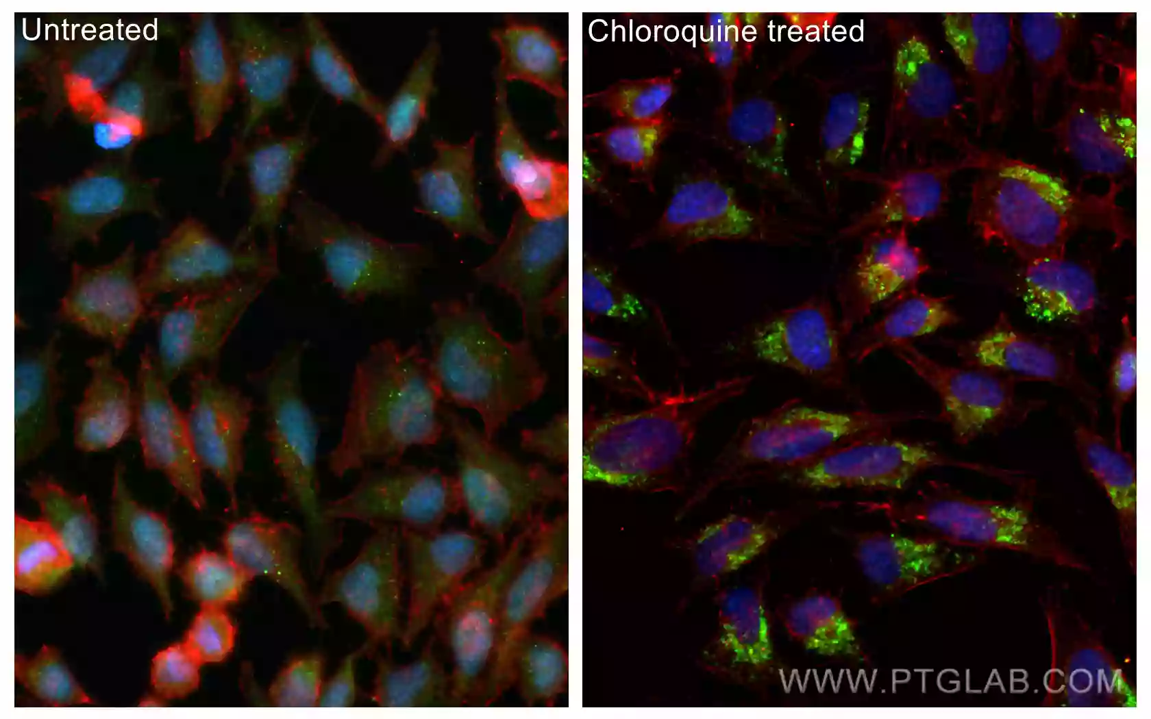 Immunofluorescence staining of HeLa using LC3 Recombinant antibody