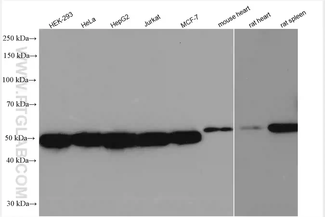 ERGIC-53 antibody (13364-1-AP) | Proteintech