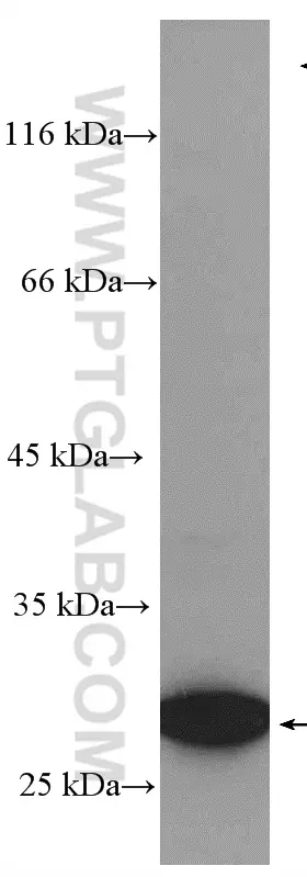 Livin antibody (27543-1-AP) | Proteintech