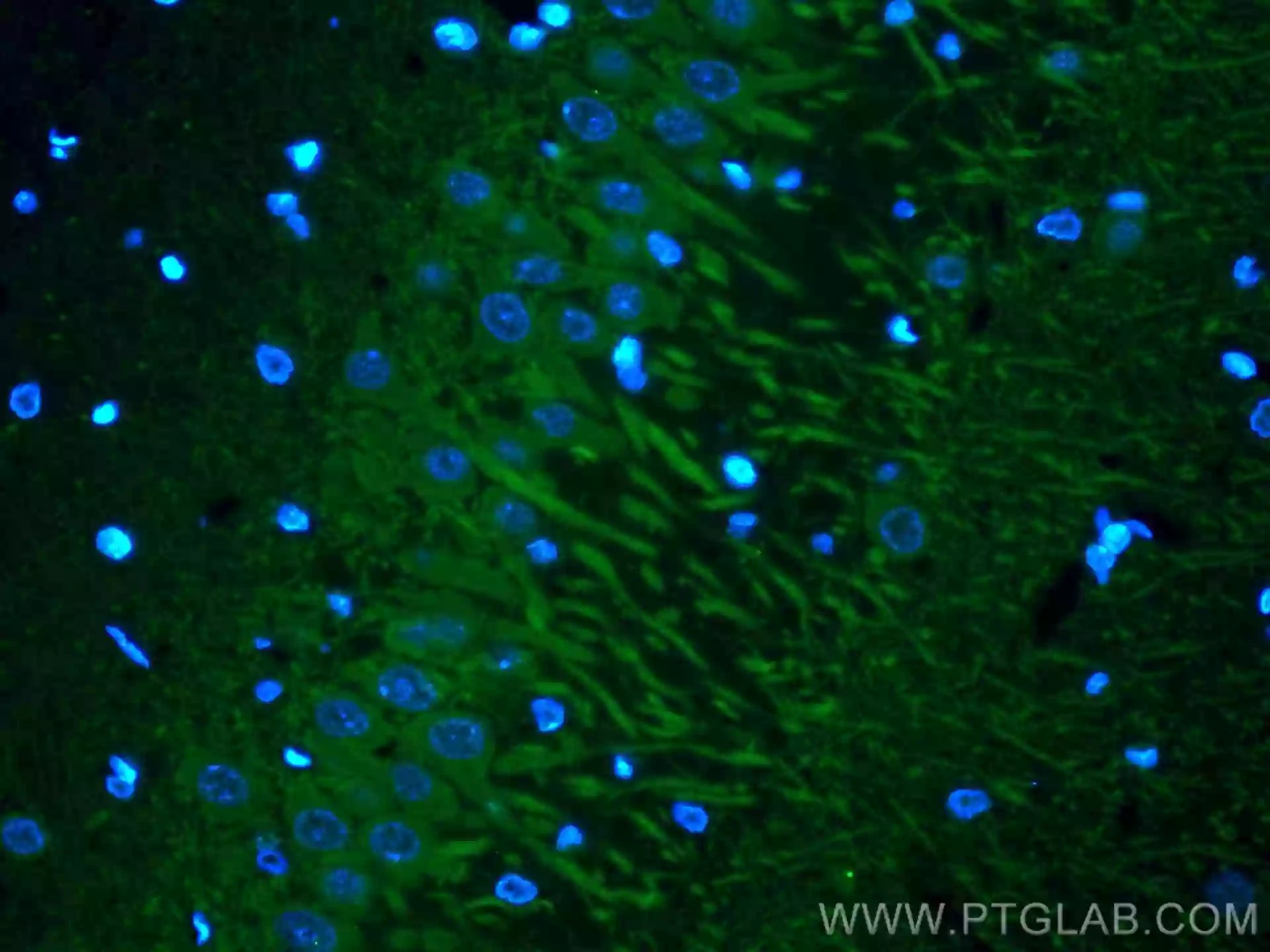 MAP2 antibody (CL488-67015) | Proteintech