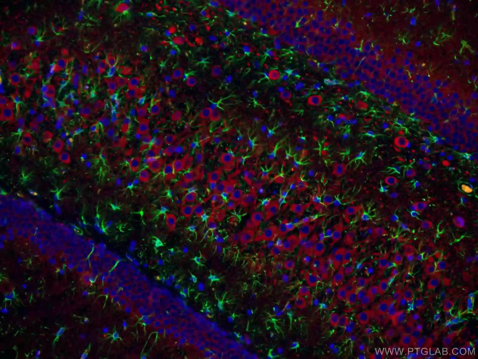 MAP2 antibody (17490-1-AP) | Proteintech