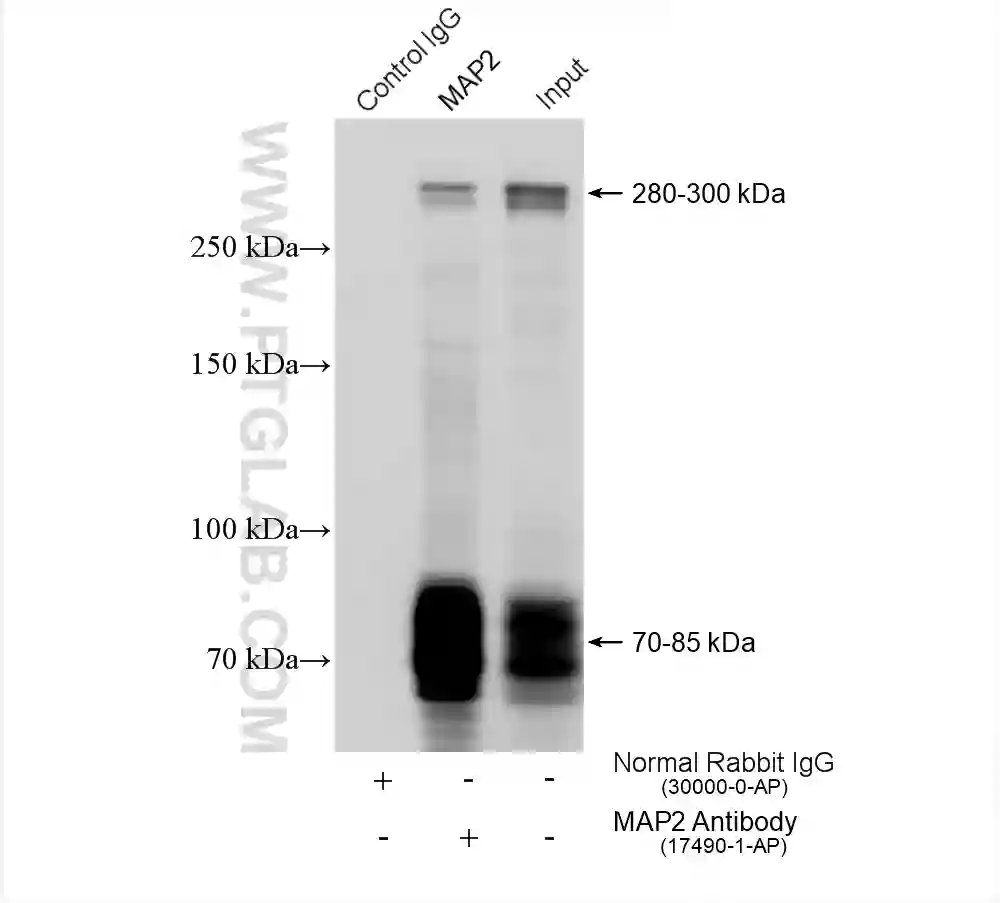 MAP2 antibody (17490-1-AP) | Proteintech