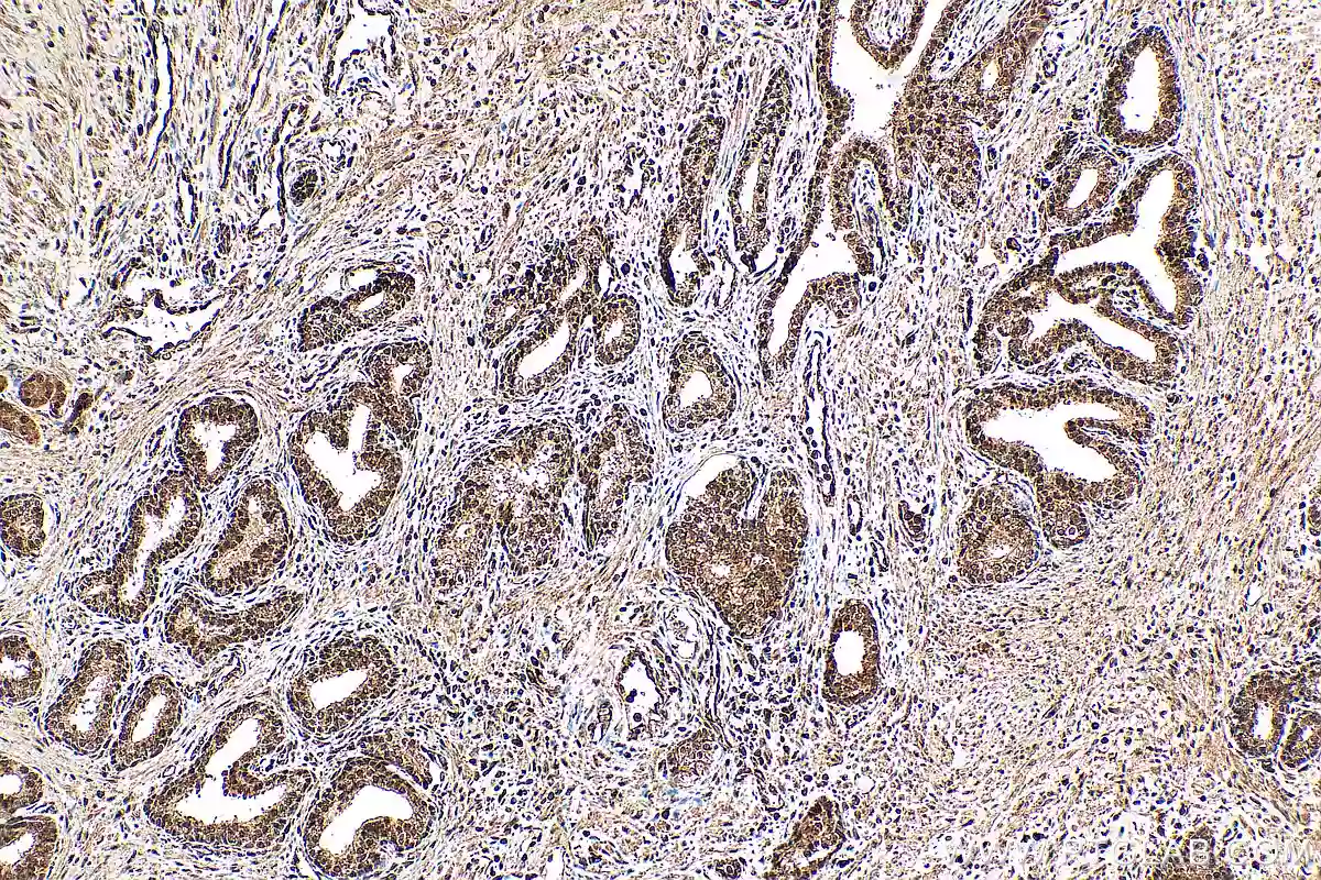 MED6 antibody (15338-1-AP) | Proteintech