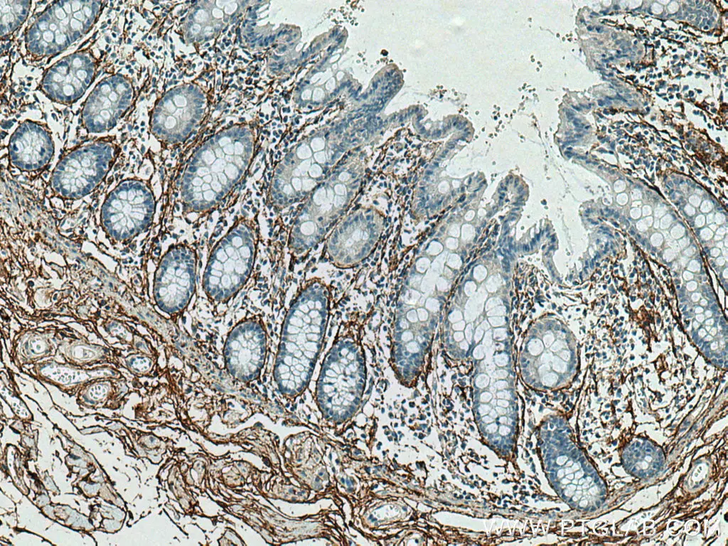 MFAP5 antibody (15727-1-AP) | Proteintech