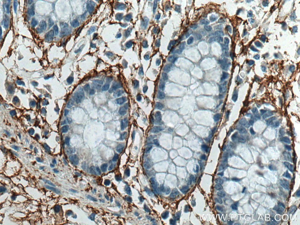 MFAP5 antibody (15727-1-AP) | Proteintech