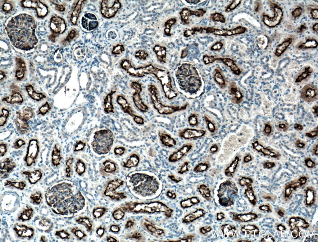 MME,CD10 antibody (60034-3-Ig) | Proteintech