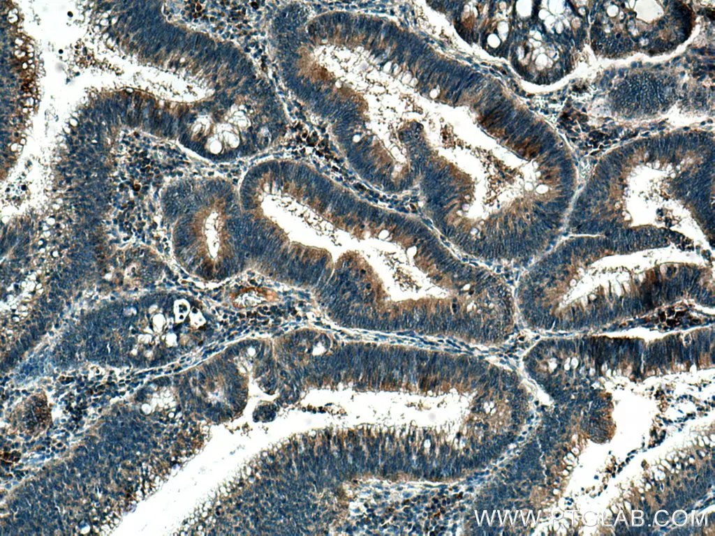 MMP7 antibody (10374-2-AP) | Proteintech