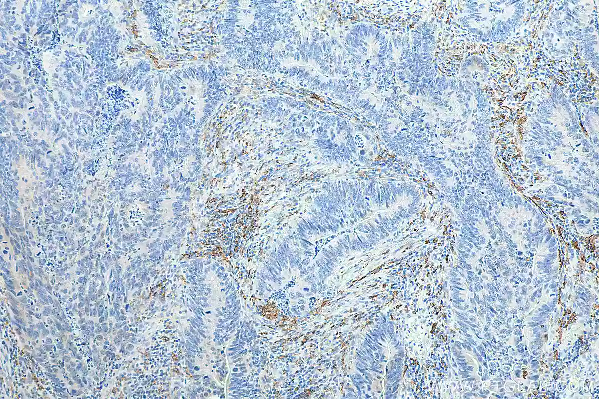 CD206 antibody (81525-1-RR) | Proteintech