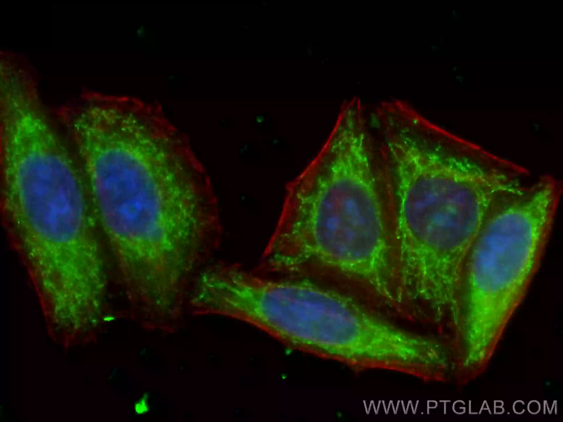 mTOR antibody (66888-1-Ig) | Proteintech