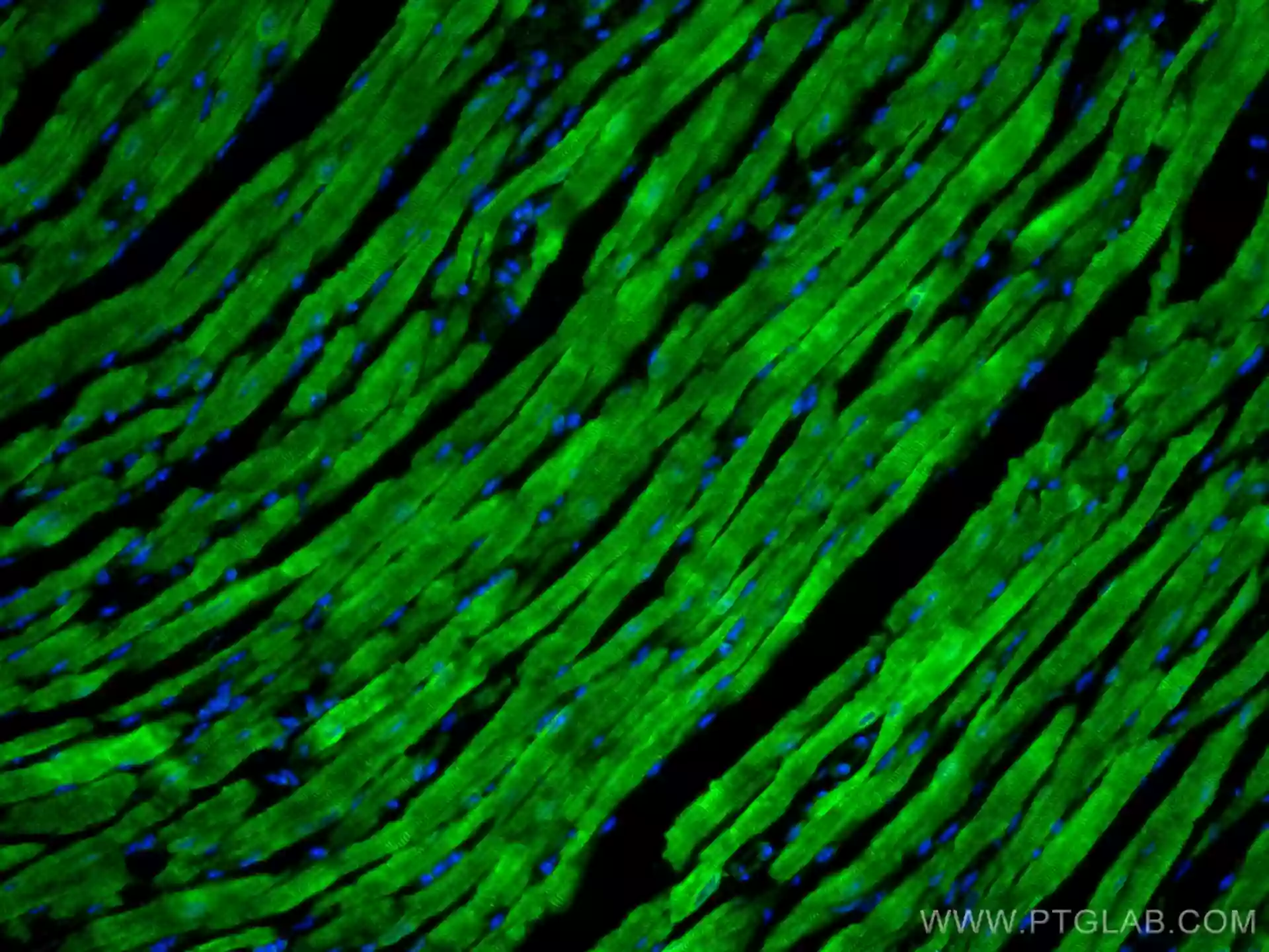 MYH7-specific antibody (22280-1-AP) | Proteintech