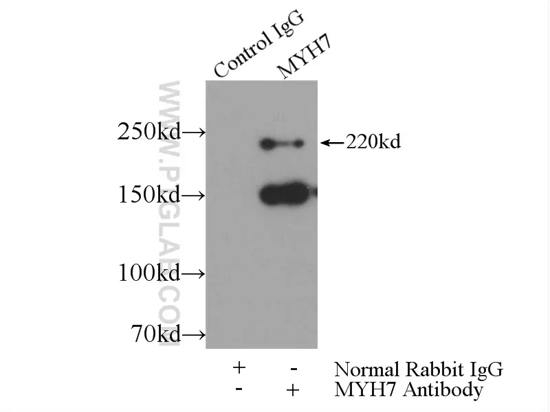 MYH7-specific antibody (22280-1-AP) | Proteintech
