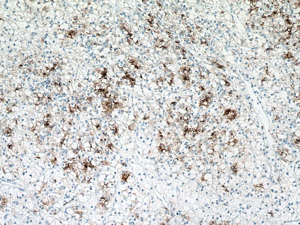 Napsin A antibody (60259-2-Ig) | Proteintech