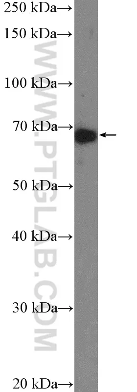 NDST1 antibody (26203-1-AP) | Proteintech