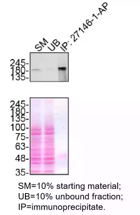 NEK1 antibody (27146-1-AP) | Proteintech