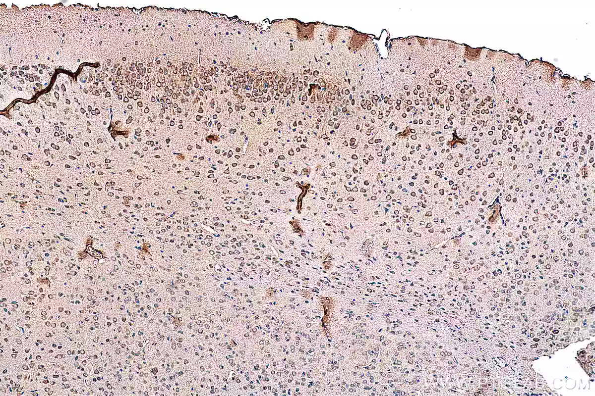 NMDAR2A/GRIN2A antibody (28571-1-AP) | Proteintech